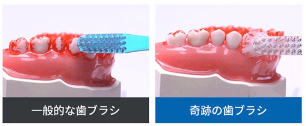 奇跡の歯ブラシ　一般の歯ブラシとの違い